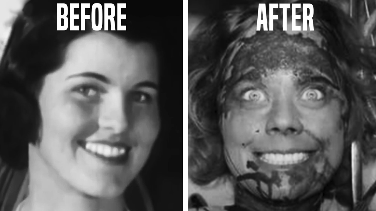 （带文本）这就是为什么脑白质切除术是历史上最糟糕的手术-咕咕的工具箱