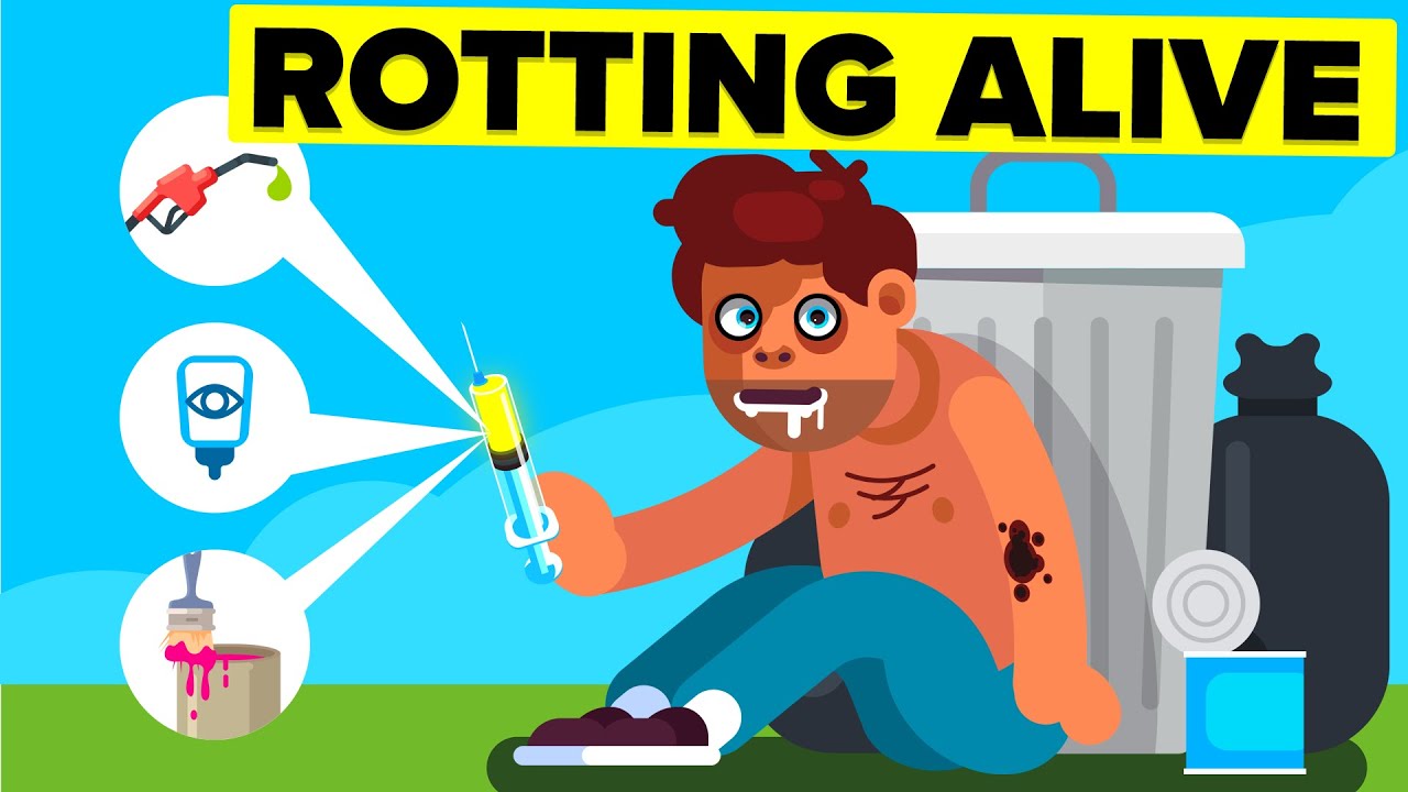 俄罗斯一种能把你变成僵尸的药物