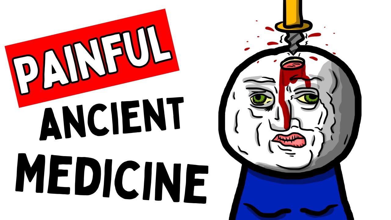 古代“医学”是狂野的