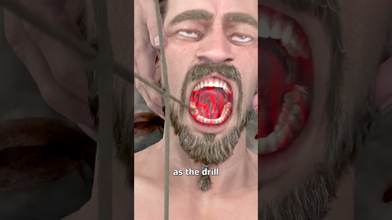 麻醉前钻牙-咕咕的工具箱