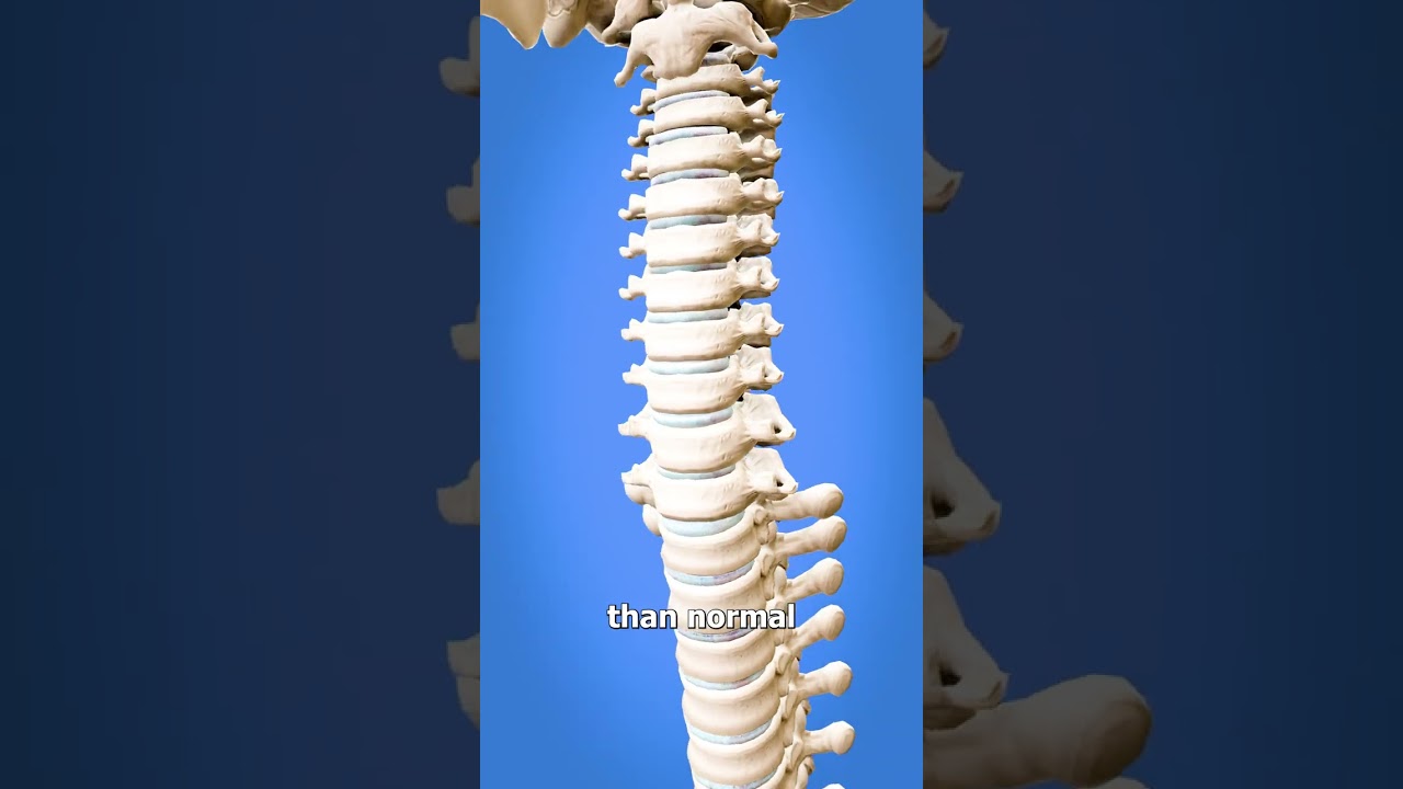 如何像猫头鹰一样旋转你的头-咕咕的工具箱