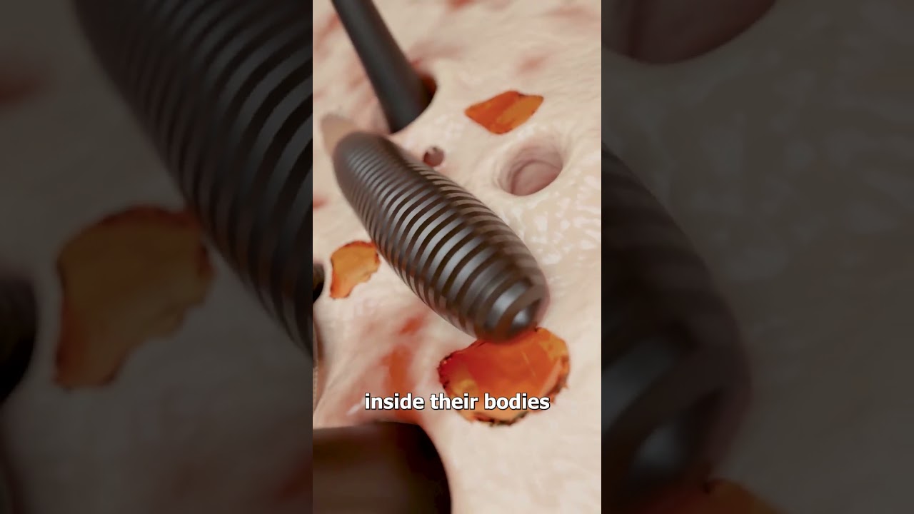 小虫子会在你的脸上排便-咕咕的工具箱