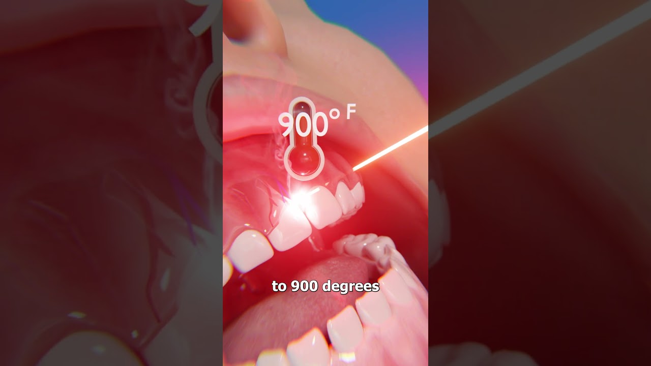 激光牙龈轮廓整形的工作原理