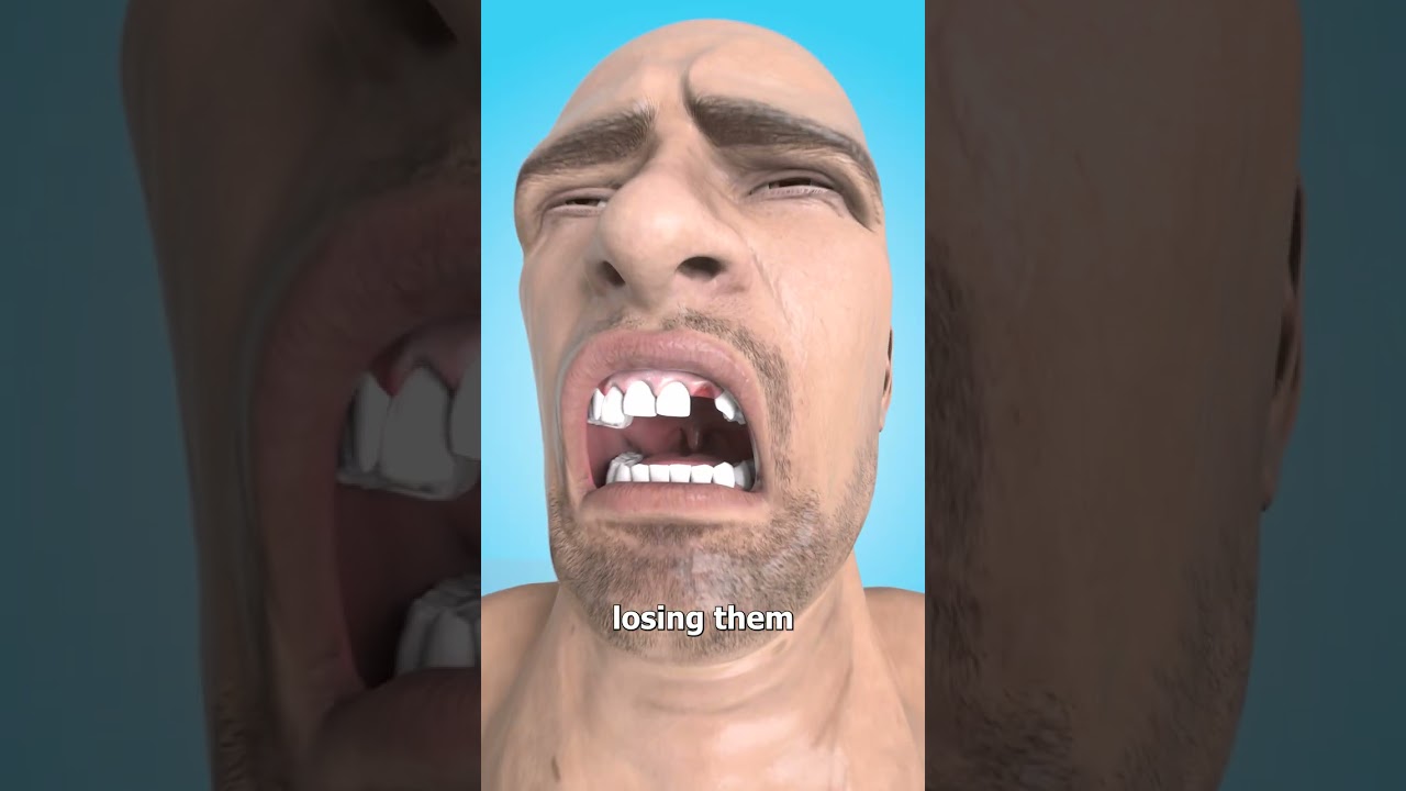 为什么你会梦见掉牙-咕咕的工具箱