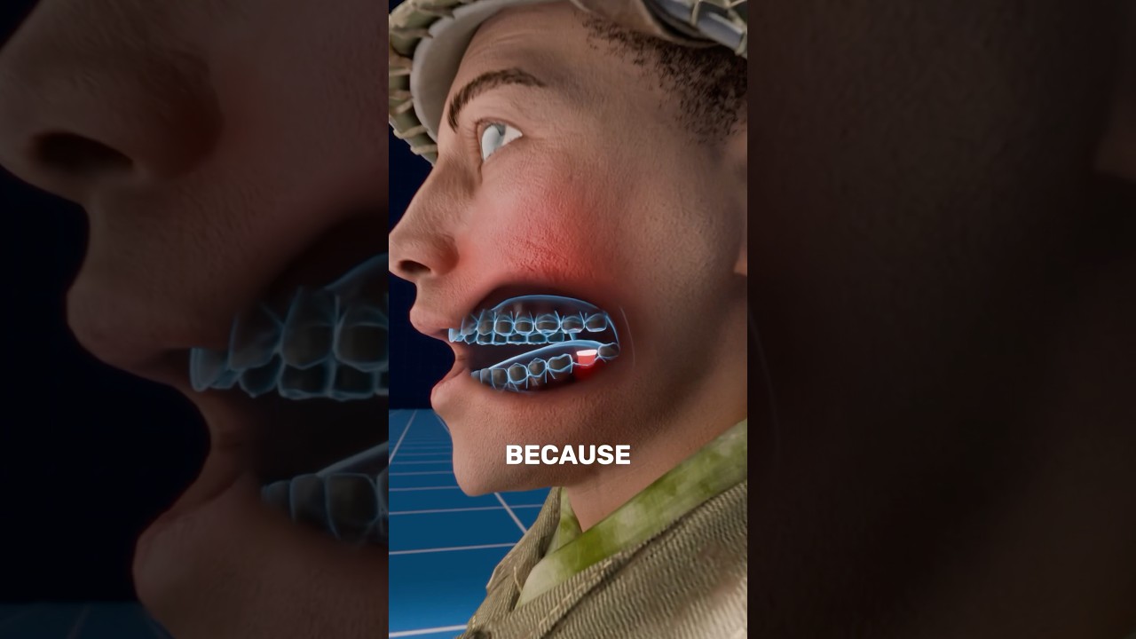 士兵在战斗中奇怪的牙齿修复-咕咕的工具箱