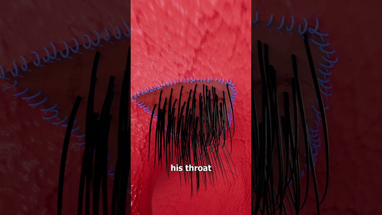 他的喉咙里长出了毛发-咕咕的工具箱