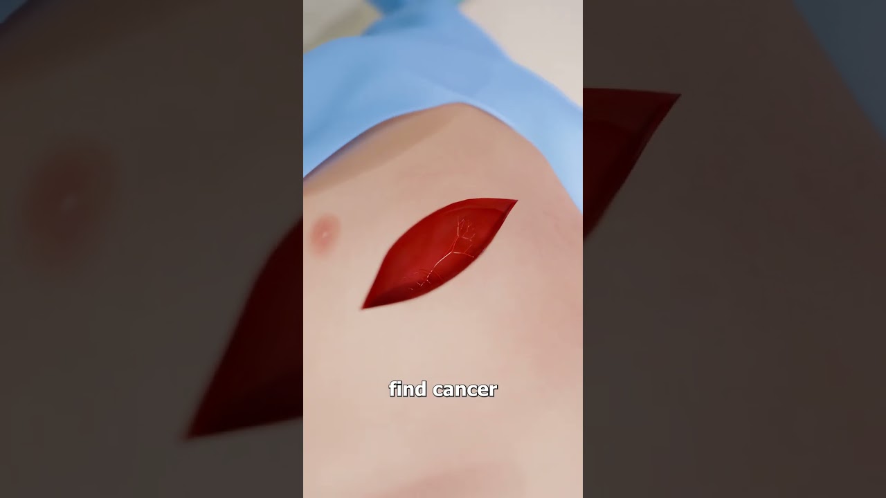 种子在男人的肺里发芽-咕咕的工具箱