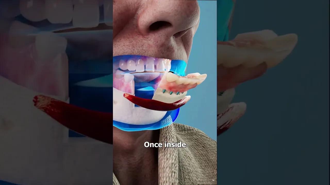 男子用自己的腿重建下巴-咕咕的工具箱