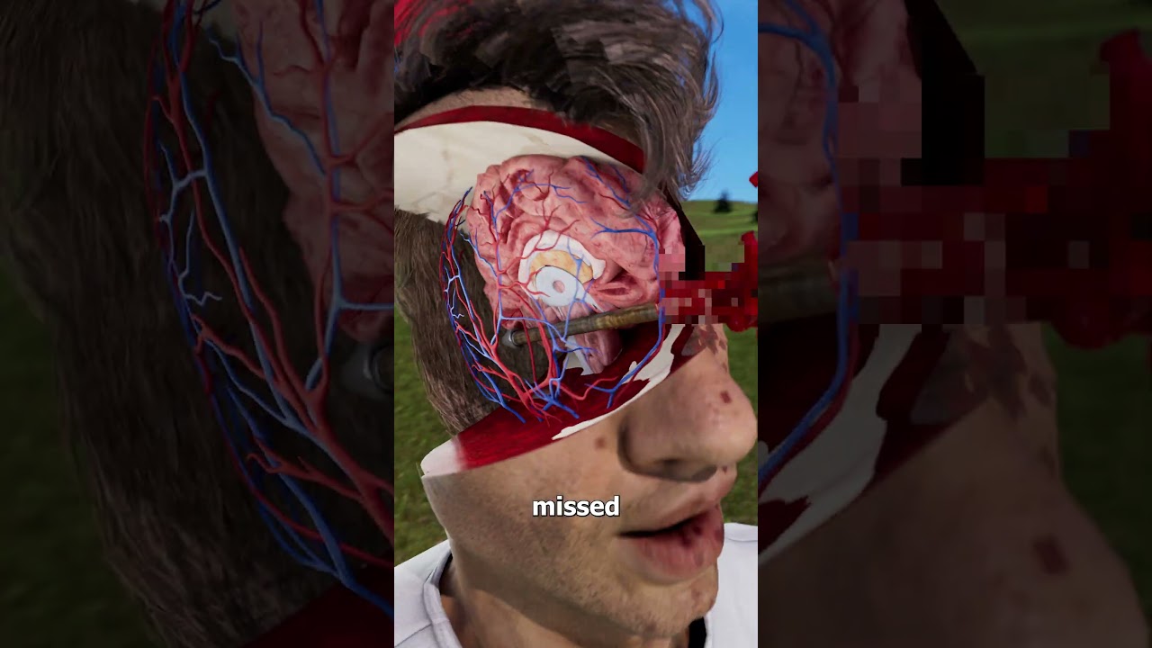 他头骨中箭后竟然活了下来-咕咕的工具箱