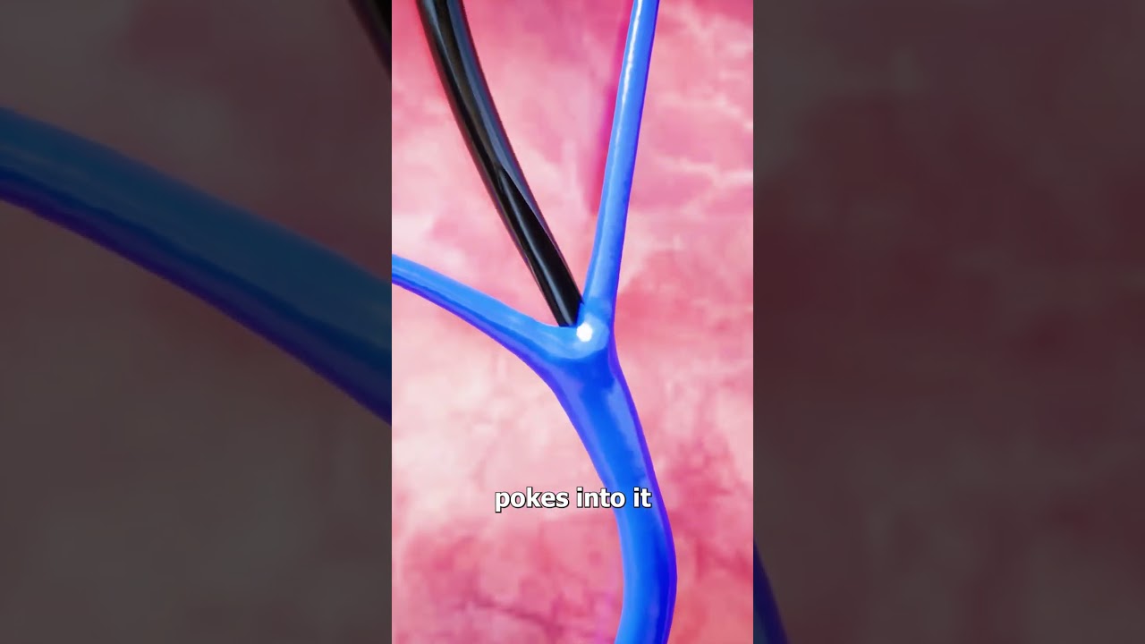 蚊子针的工作原理-咕咕的工具箱