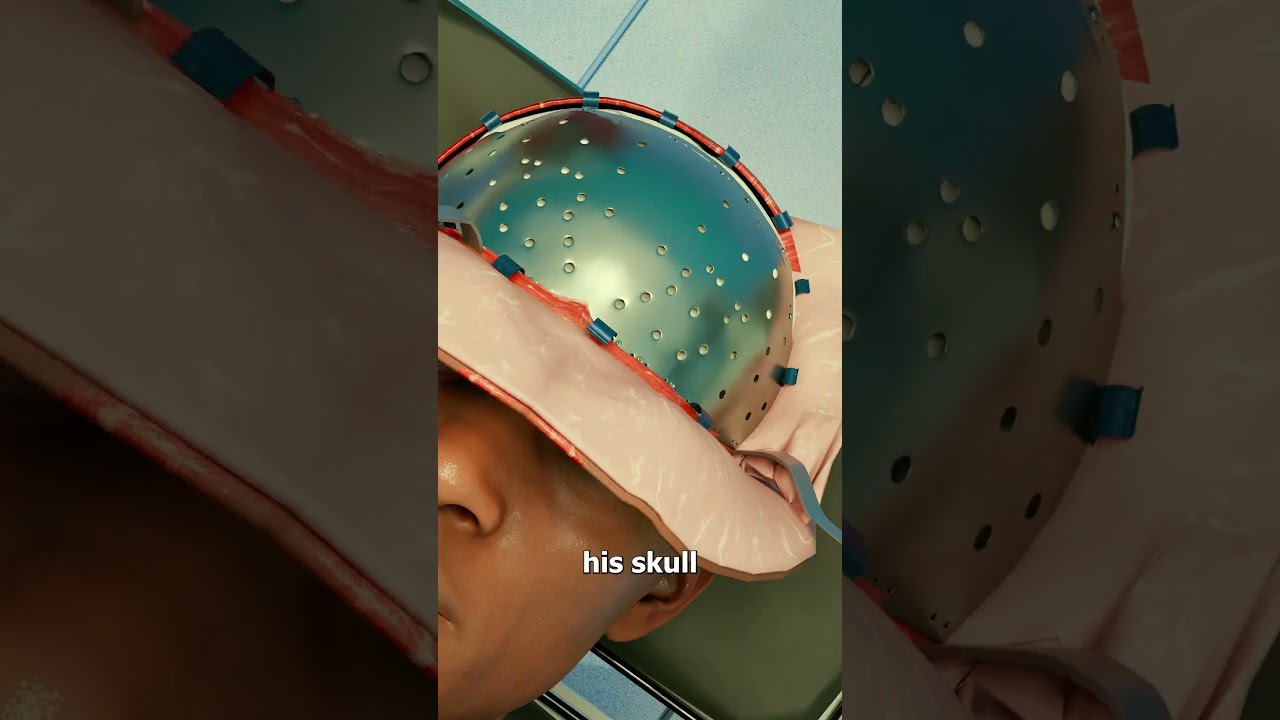 救了他一命的金属板-咕咕的工具箱