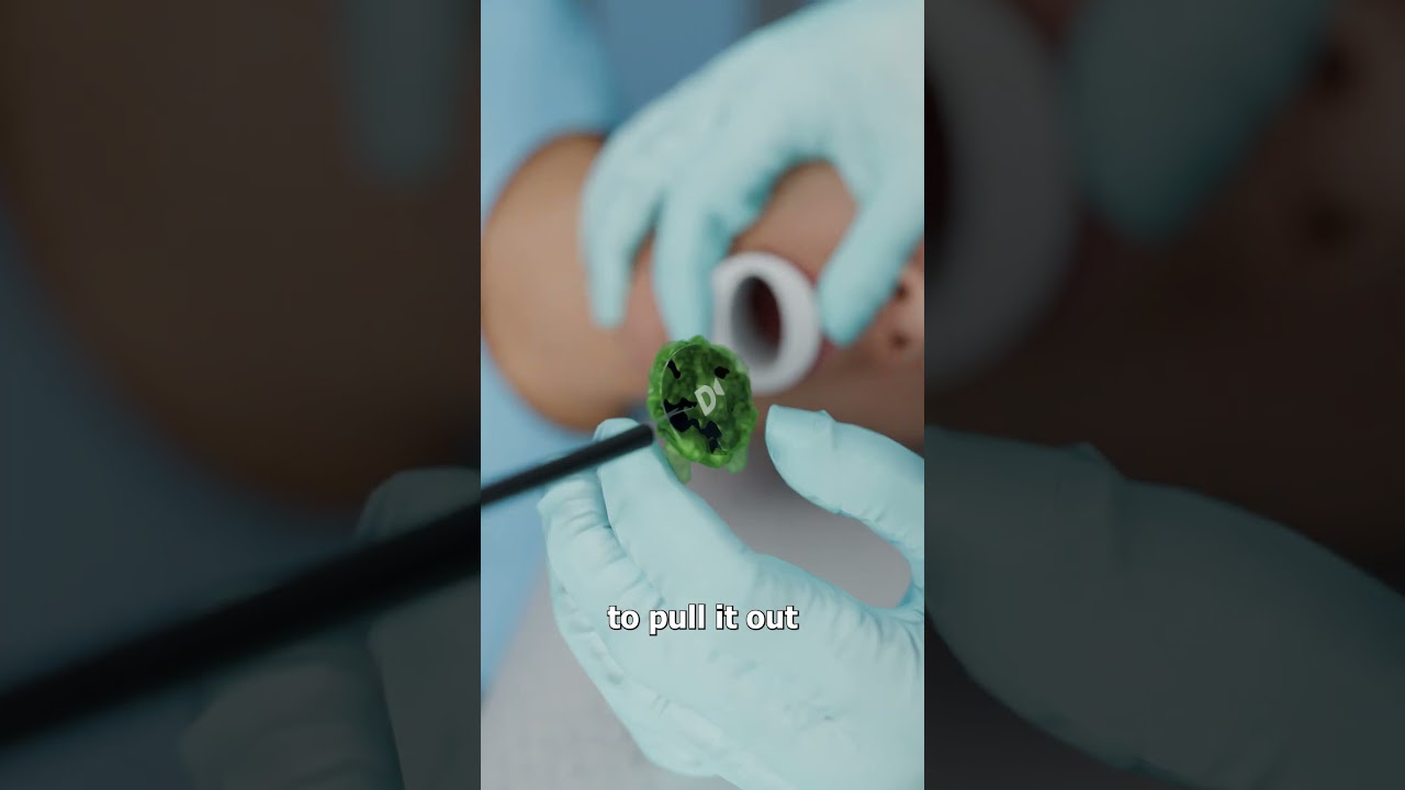 她不小心吞下了她的健身追踪器-咕咕的工具箱