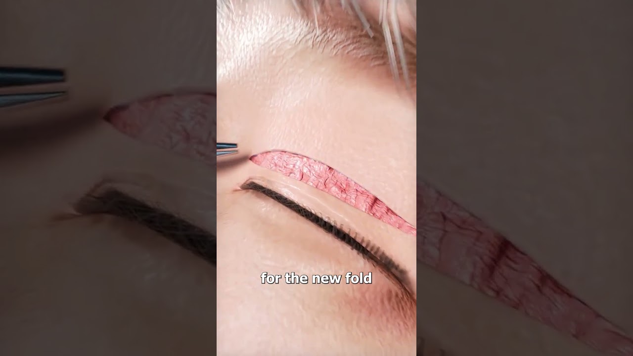 双眼皮手术的原理-咕咕的工具箱