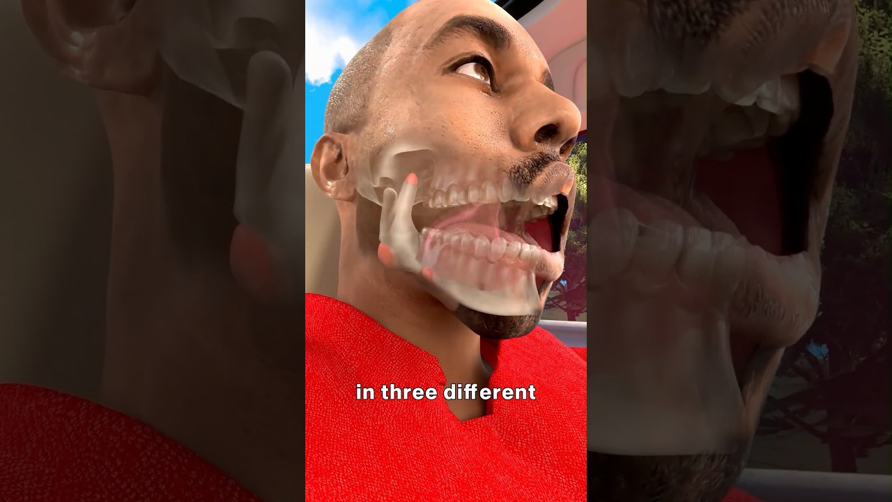 坎耶·韦斯特车祸摔断下巴-咕咕的工具箱