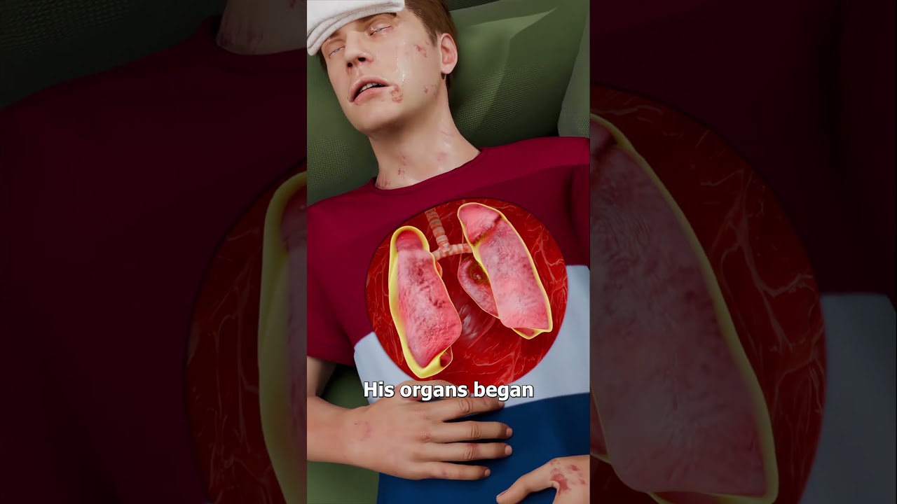 一根内生毛发竟让他陷入昏迷-咕咕的工具箱