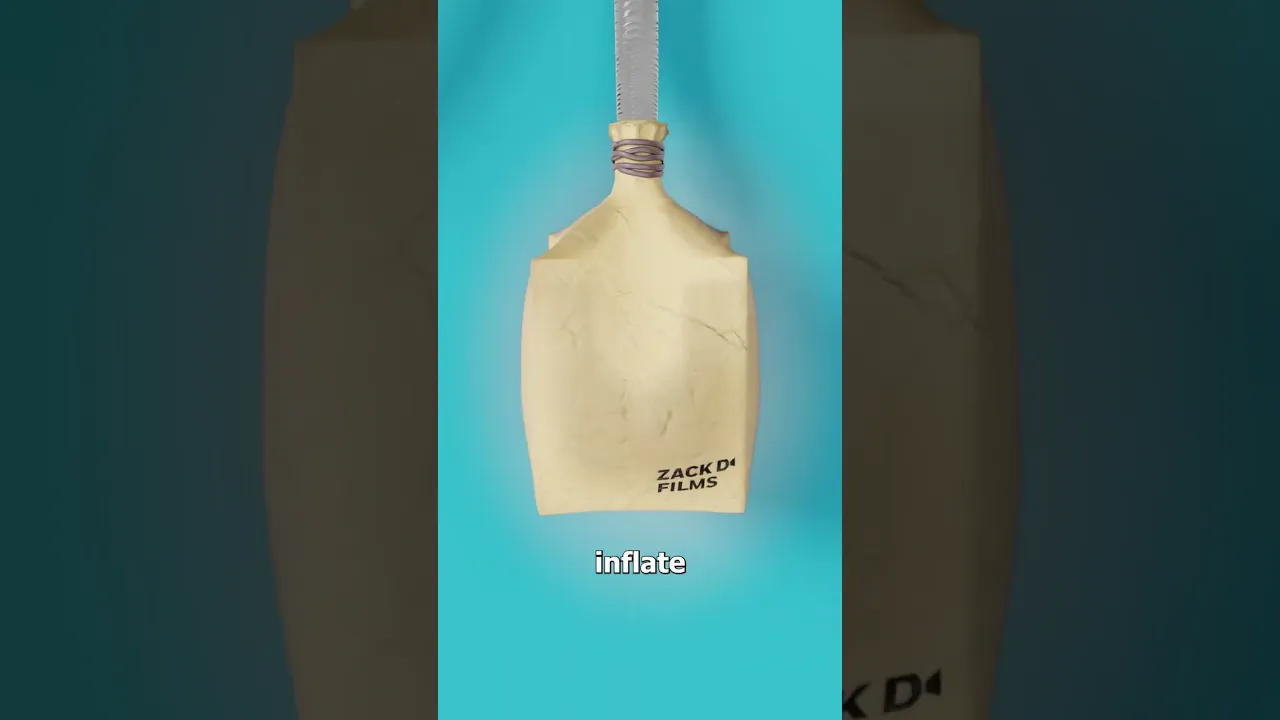这台机器能让呼吸永不停歇